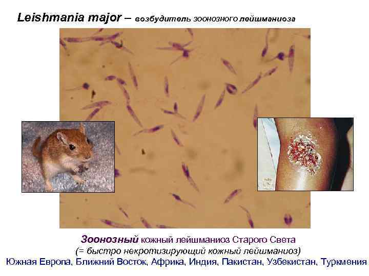 Leishmania major – возбудитель ЗООНОЗНОГО лейшманиоза Зоонозный кожный лейшманиоз Старого Света (= быстро некротизирующий
