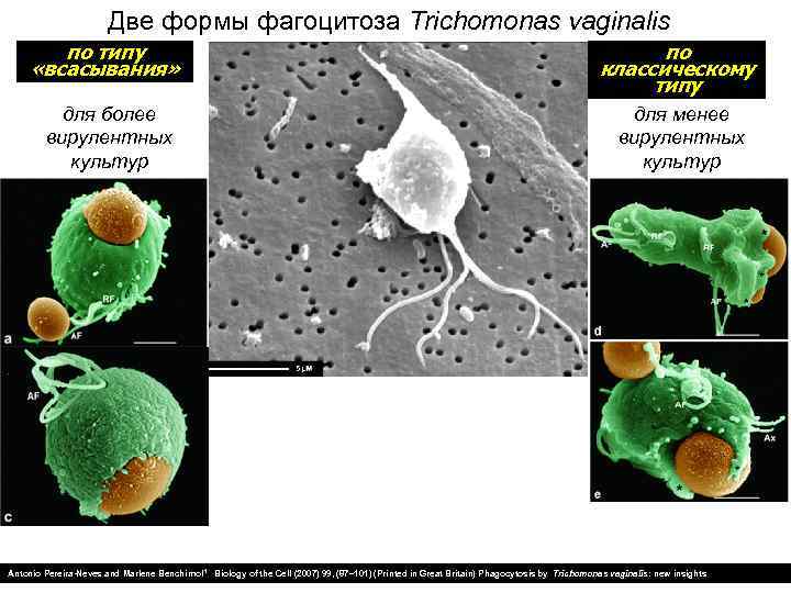 Две формы фагоцитоза Trichomonas vaginalis по типу «всасывания» по классическому типу для более вирулентных