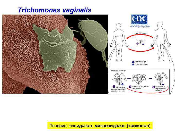 Trichomonas vaginalis Лечение: тинидазол, метронидазол (трихопол) 