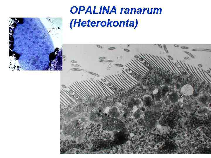 OPALINA ranarum (Heterokonta) 