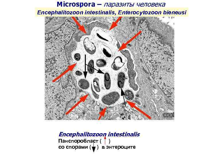 Microspora – паразиты человека Encephalitozoon intestinalis, Enterocytozoon bieneusi Encephalitozoon intestinalis Панспоробласт ( ) cо