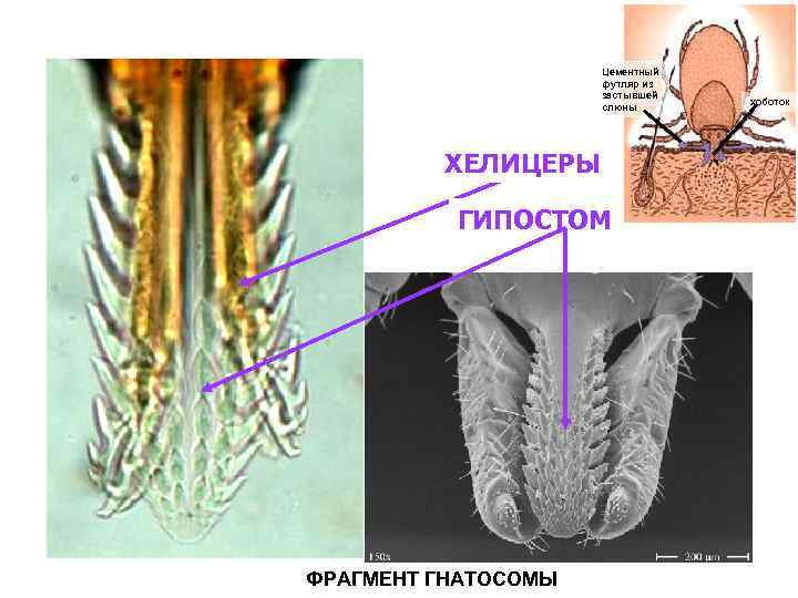 Как выглядит хоботок клеща под микроскопом фото