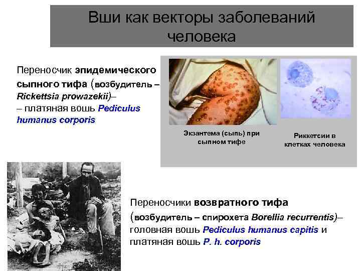 Вши как векторы заболеваний человека Переносчик эпидемического сыпного тифа (возбудитель – Rickettsia prowazekii)– –