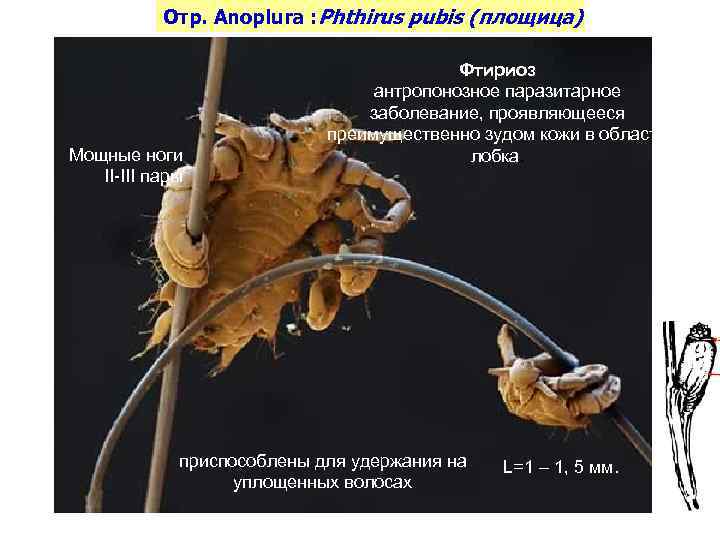 Отр. Anoplura : Phthirus pubis (площица) Мощные ноги II-III пары Фтириоз антропонозное паразитарное заболевание,
