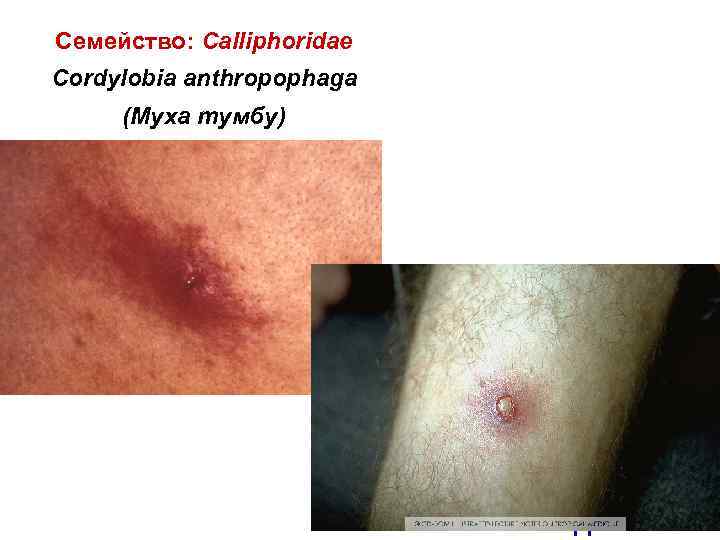 Семейство: Calliphoridae Cordylobia anthropophaga (Муха тумбу) Африка 