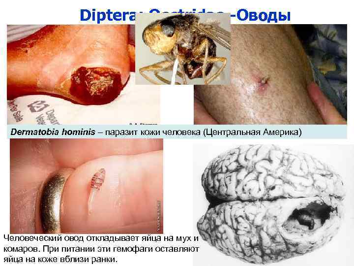  Diptera: Oestridae -Оводы Dermatobia hominis – паразит кожи человека (Центральная Америка) Человеческий овод