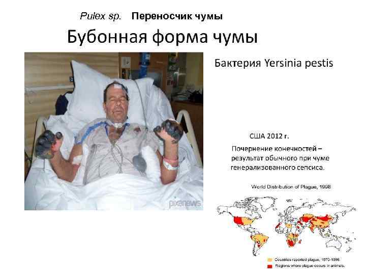  Pulex sp. Переносчик чумы 