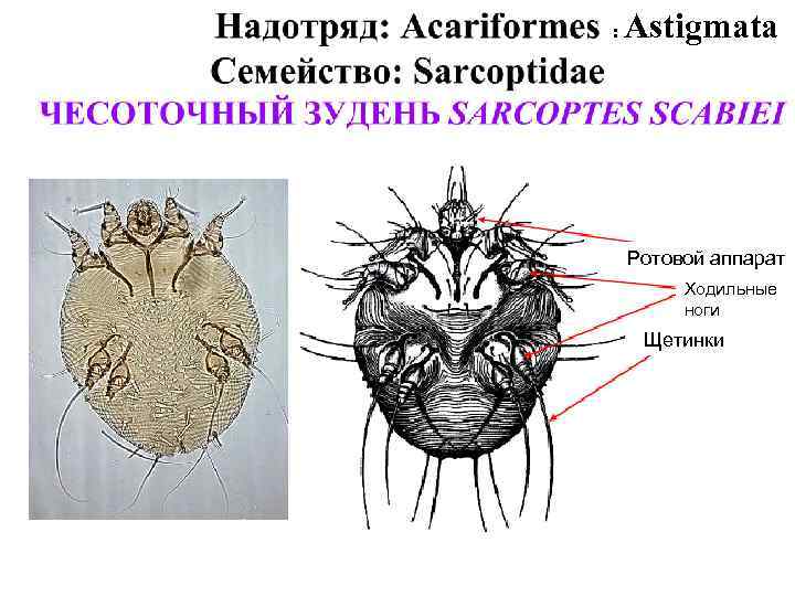 Почему чесоточного клеща часто называют зуднем ответ. Чесоточный клещ Sarcoptes scabiei. Чесоточный зудень Sarcoptes scabiei строение. Жизненный цикл чесоточного клеща схема. Чесоточный зудень (Sarcoptes scabiei) укусы.