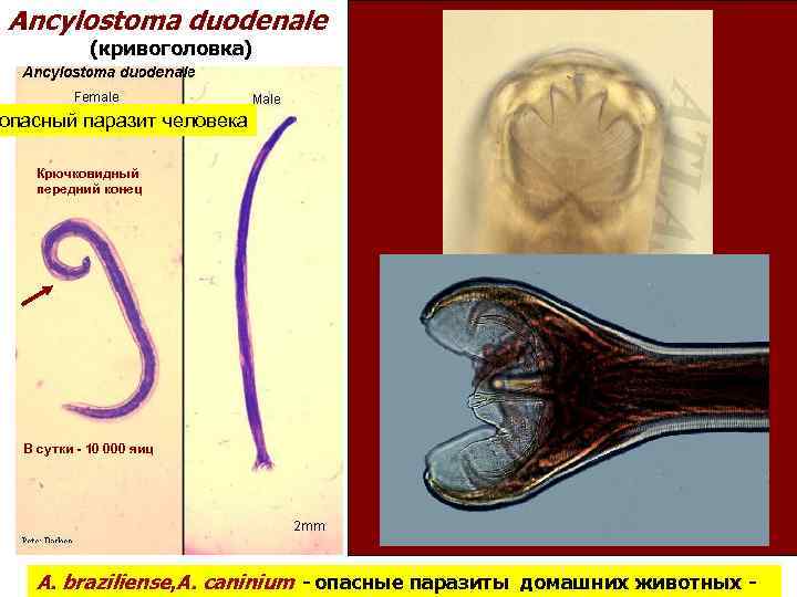 Ancylostoma duodenale (кривоголовка) опасный паразит человека Крючковидный передний конец В сутки - 10 000