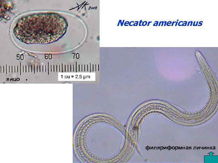 Necator americanus яйцо филяриформная личинка 