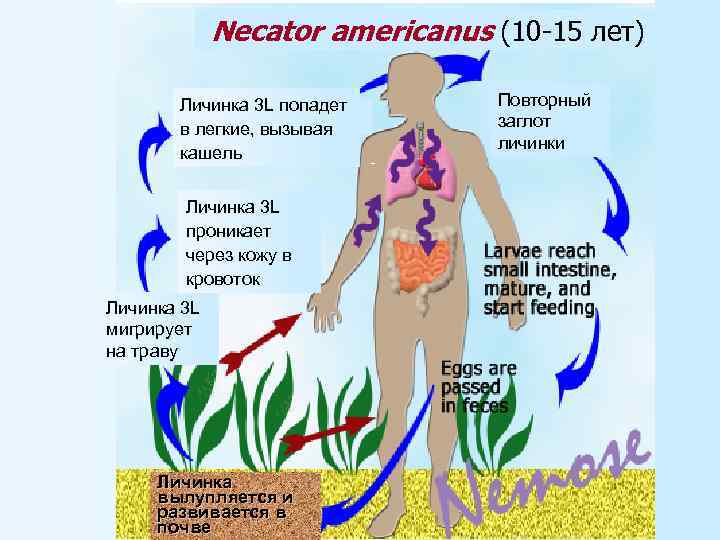 Necator americanus (10 -15 лет) Личинка 3 L попадет в легкие, вызывая кашель Личинка