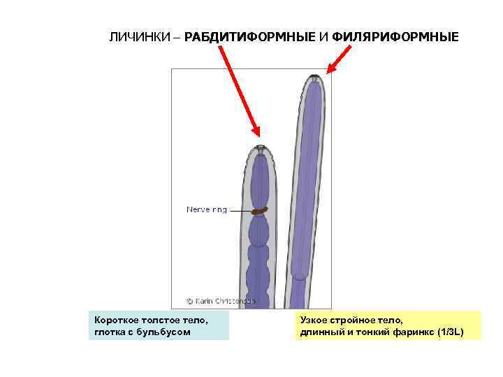 ЛИЧИНКИ – РАБДИТИФОРМНЫЕ И ФИЛЯРИФОРМНЫЕ Короткое толстое тело, глотка с бульбусом Узкое стройное тело,