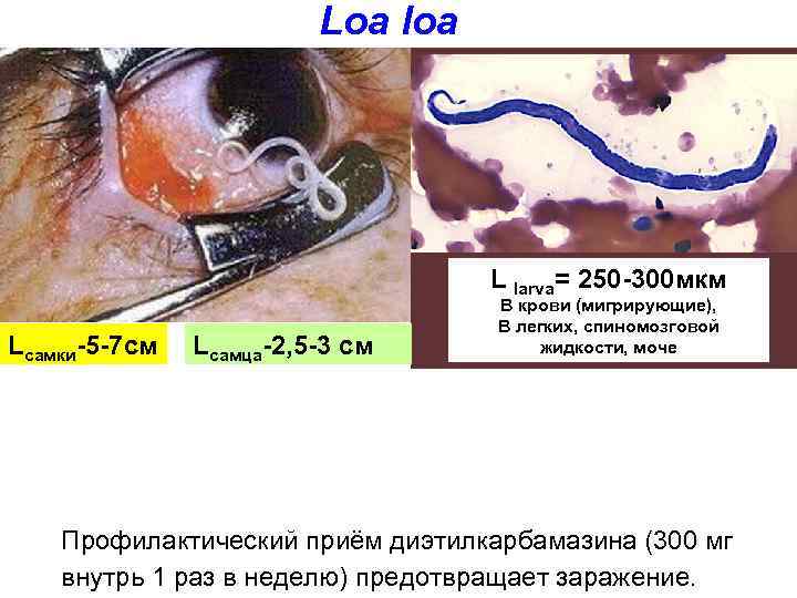 Loa loa L larva= 250 -300 мкм Lсамки-5 -7 см Lсамца-2, 5 -3 см