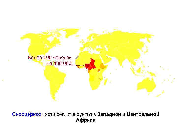 Более 400 человек на 100 000 Онхоцеркоз часто регистрируется в Западной и Центральной Африке