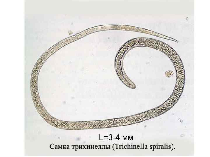 L=3 -4 мм 