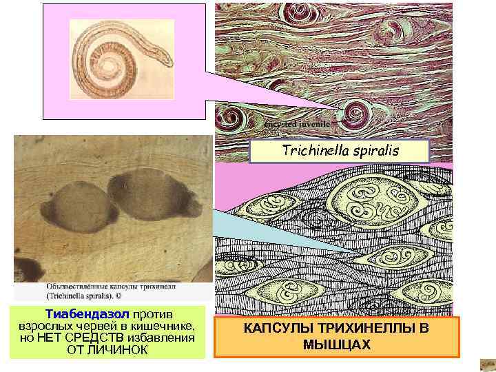 Инкапсулированные личинки трихинеллы в мышцах рисунок с обозначениями