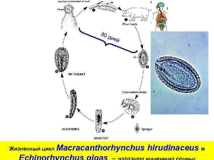 80 дне й АКАНТОР Жизненный цикл Macracanthorhynchus hirudinaceus и 