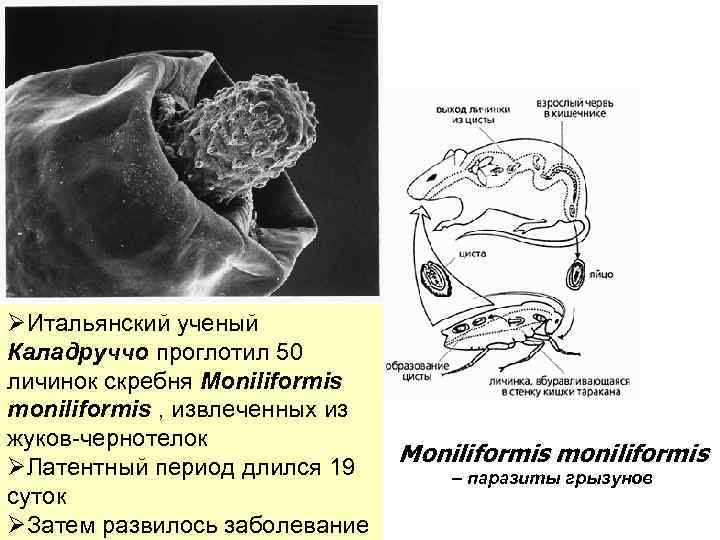 ØИтальянский ученый Каладруччо проглотил 50 личинок скребня Moniliformis moniliformis , извлеченных из жуков-чернотелок Moniliformis