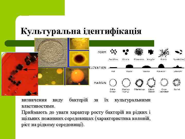 Культуральна ідентифікація визначення виду бактерій за їх культуральними властивостями. Приймають до уваги характер росту