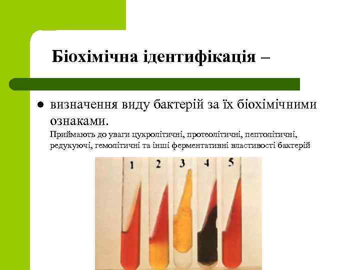 Біохімічна ідентифікація – l визначення виду бактерій за їх біохімічними ознаками. Приймають до уваги