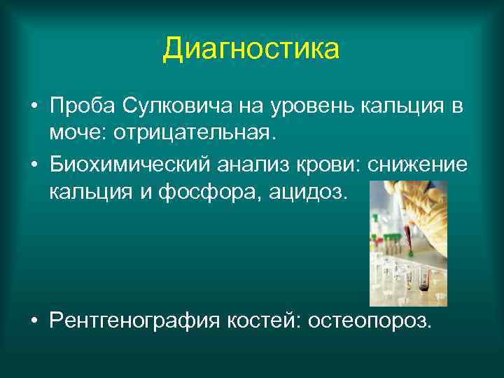 Диагностика • Проба Сулковича на уровень кальция в моче: отрицательная. • Биохимический анализ крови: