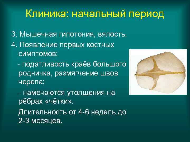 Клиника: начальный период 3. Мышечная гипотония, вялость. 4. Появление первых костных симптомов: - податливость