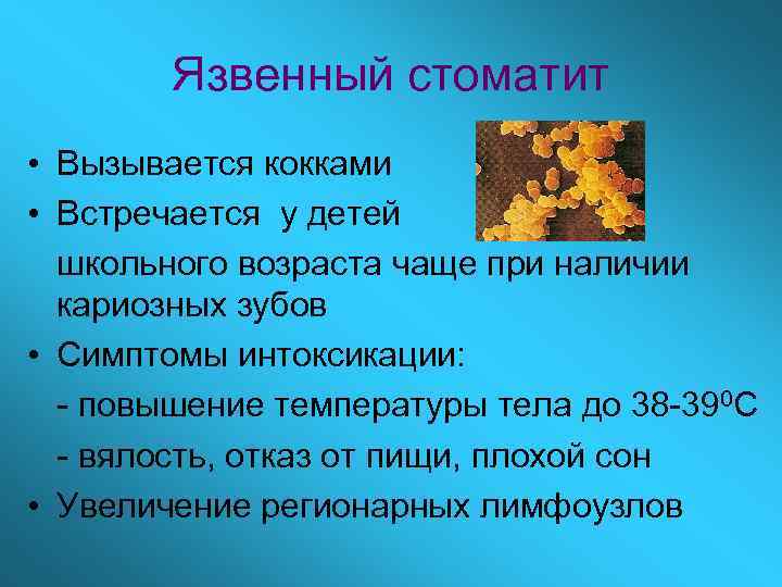 Язвенный стоматит • Вызывается кокками • Встречается у детей школьного возраста чаще при наличии