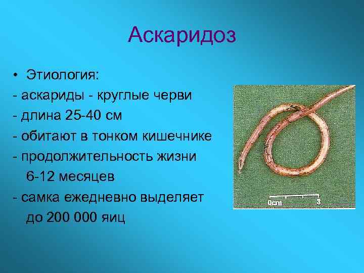 Аскаридоз • Этиология: - аскариды - круглые черви - длина 25 -40 см -
