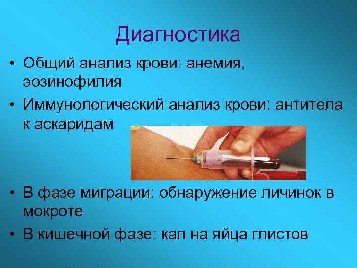 Диагностика • Общий анализ крови: анемия, эозинофилия • Иммунологический анализ крови: антитела к аскаридам