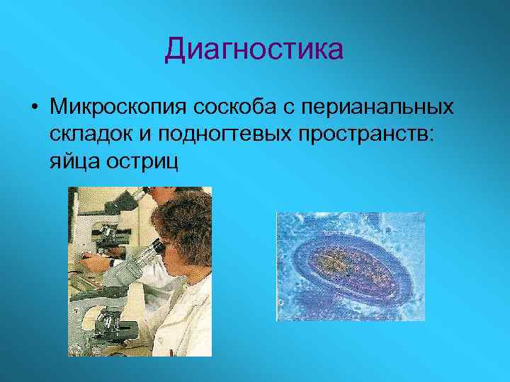 Диагностика • Микроскопия соскоба с перианальных складок и подногтевых пространств: яйца остриц 
