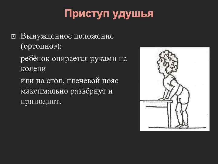 Приступ удушья Вынужденное положение (ортопноэ): ребёнок опирается руками на колени или на стол, плечевой