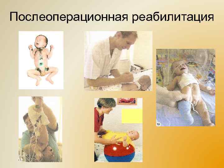 Послеоперационная реабилитация 