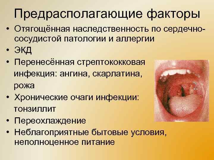 Предрасполагающие факторы • Отягощённая наследственность по сердечнососудистой патологии и аллергии • ЭКД • Перенесённая