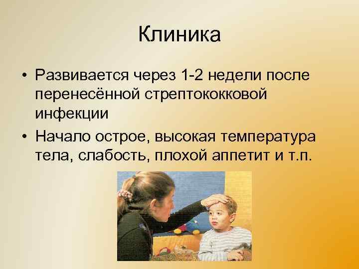 Клиника • Развивается через 1 -2 недели после перенесённой стрептококковой инфекции • Начало острое,