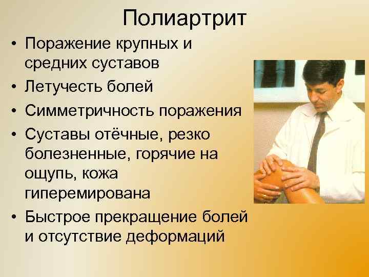 Полиартрит • Поражение крупных и средних суставов • Летучесть болей • Симметричность поражения •