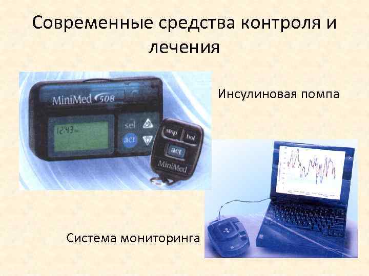 Современные средства контроля и лечения Инсулиновая помпа Система мониторинга 