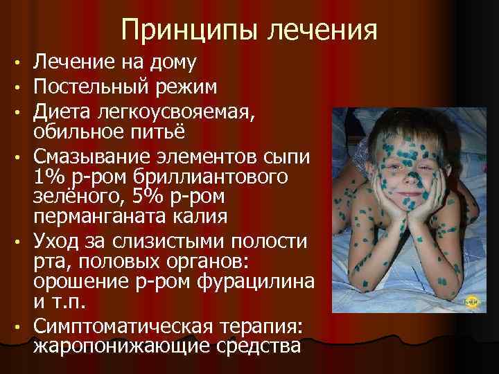 Принципы лечения • • • Лечение на дому Постельный режим Диета легкоусвояемая, обильное питьё