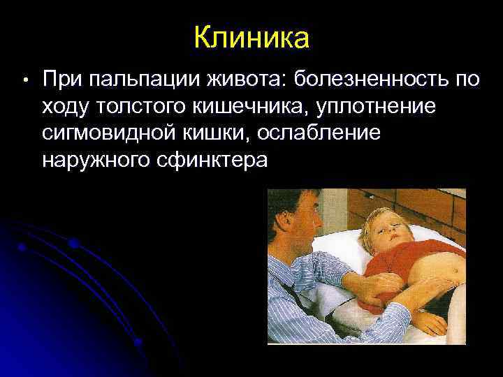 Клиника • При пальпации живота: болезненность по ходу толстого кишечника, уплотнение сигмовидной кишки, ослабление