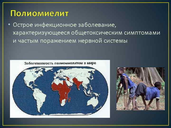 Полиомиелит • Острое инфекционное заболевание, характеризующееся общетоксическим симптомами и частым поражением нервной системы 