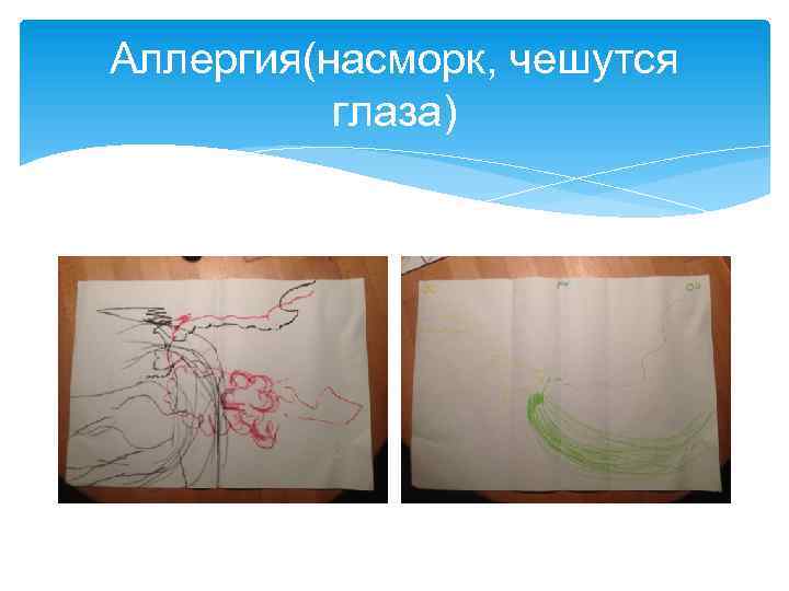 Аллергия(насморк, чешутся глаза) 