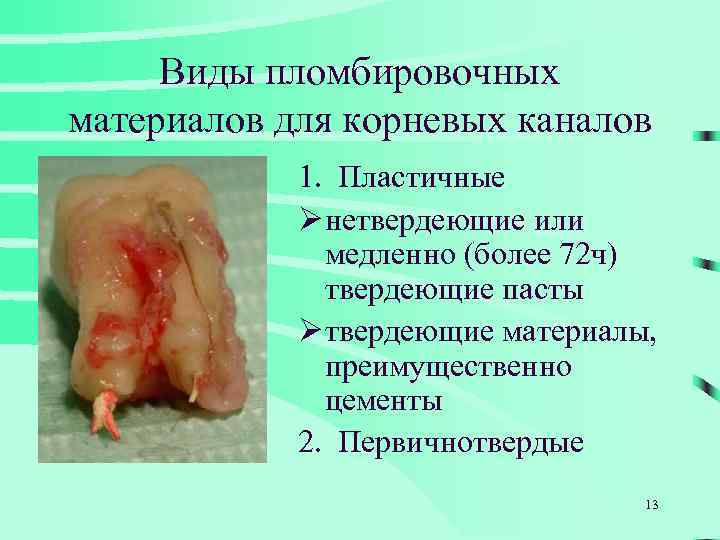 Виды пломбировочных материалов для корневых каналов 1. Пластичные Ø нетвердеющие или медленно (более 72