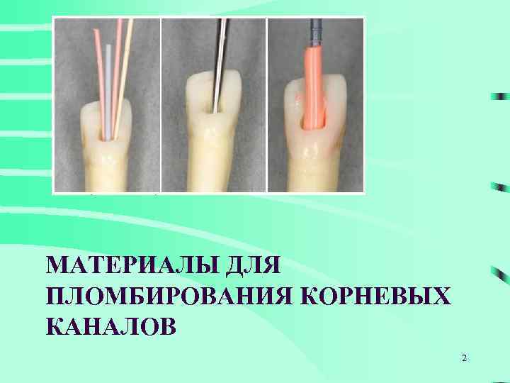 МАТЕРИАЛЫ ДЛЯ ПЛОМБИРОВАНИЯ КОРНЕВЫХ КАНАЛОВ 2 