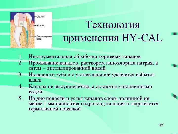 Технология применения HY-CAL 1. 2. 3. 4. 5. Инструментальная обработка корневых каналов Промывание каналов
