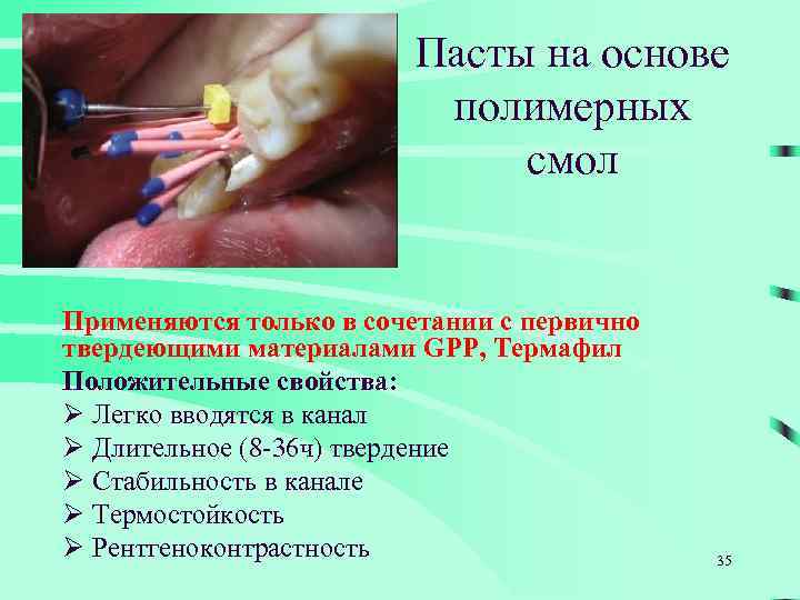 Пасты на основе полимерных смол Применяются только в сочетании с первично твердеющими материалами GPP,