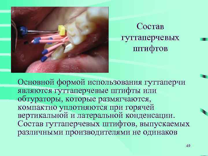 Состав гуттаперчевых штифтов Основной формой использования гуттаперчи являются гуттаперчевые штифты или обтураторы, которые размягчаются,