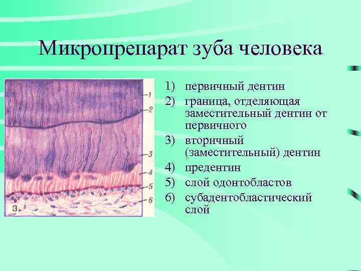 Микропрепарат зуба человека 1) первичный дентин 2) граница, отделяющая заместительный дентин от первичного 3)