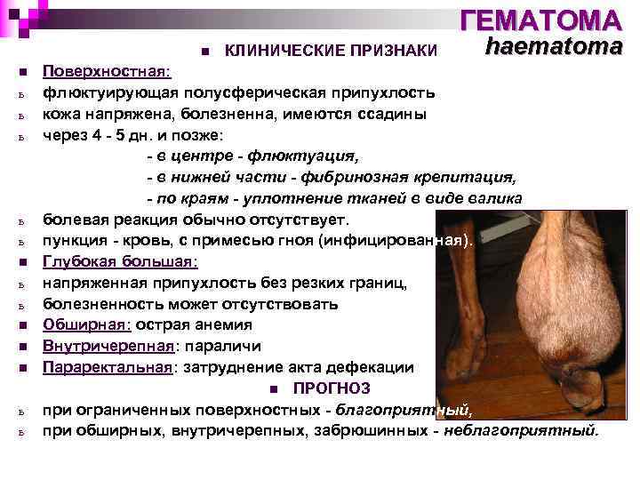 ГЕМАТОМА n n ь ь ь n n n ь ь КЛИНИЧЕСКИЕ ПРИЗНАКИ haematoma