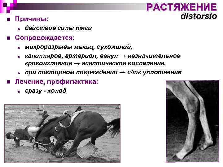 РАСТЯЖЕНИЕ n Причины: ь n distorsio действие силы тяги Сопровождается: микроразрывы мышц, сухожилий, ь