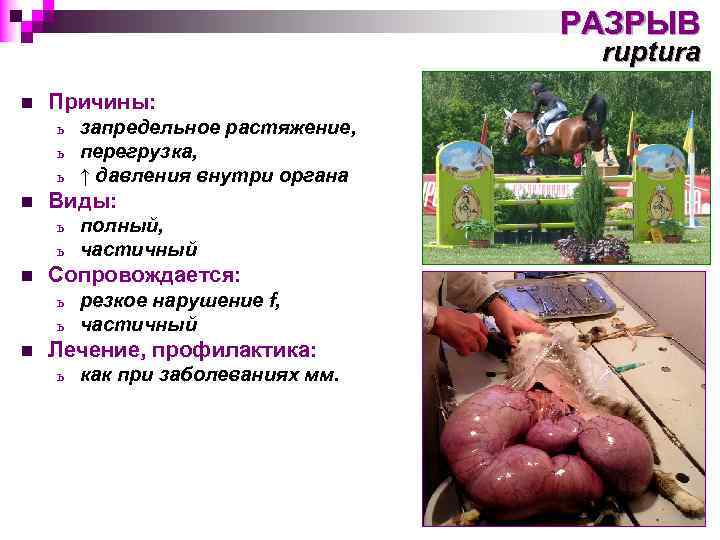 РАЗРЫВ ruptura n Причины: ь ь ь n Виды: ь ь n полный, частичный