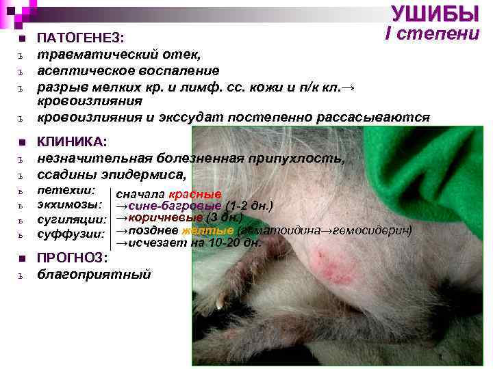 УШИБЫ n ь ь ь n ь I степени ПАТОГЕНЕЗ: травматический отек, асептическое воспаление